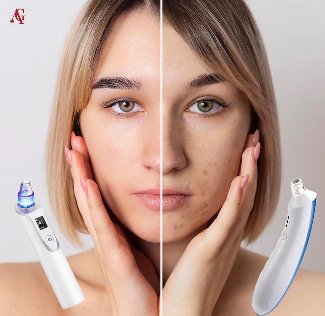 میکرودرم چیست؟ بهترین دستگاه های میکرودرم خانگی